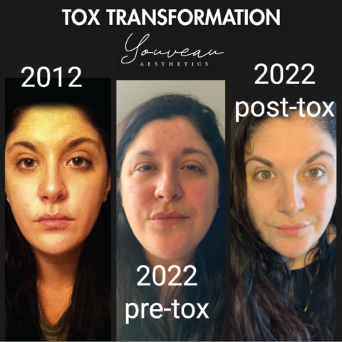 TOX