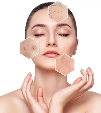 Clearer Skin with Face Reality: A Proven Solution for Acne